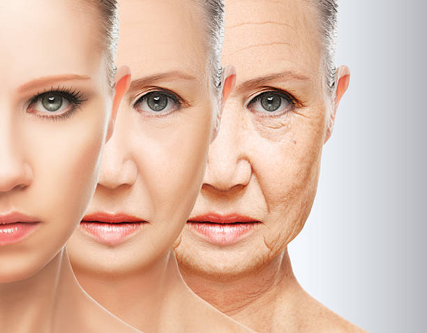 Skin Wrinkles | Top Skin Wrinkles Treatment in India | Medispa India