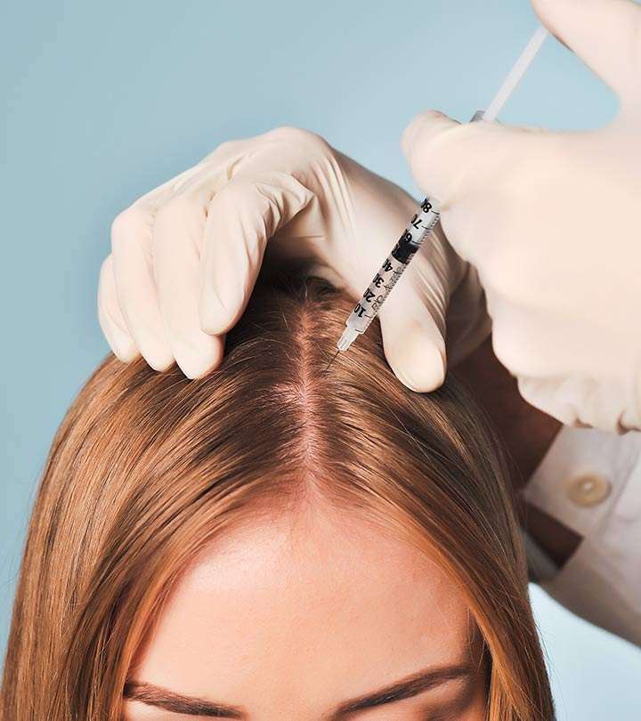 How Does Mesotherapy Work in the Hair Growth