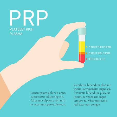 PRP Hair Restoration